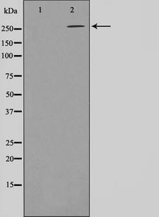 Acetyl-CoA Carboxylase / ACC Antibody - Western blot analysis of ACC1 phosphorylation expression in Insulin treated K562 whole cells lysates. The lane on the left is treated with the antigen-specific peptide.