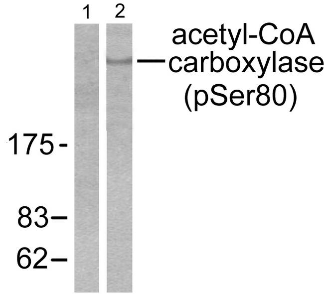 Acetyl-CoA Carboxylase / ACC Antibody - Western blot analysis of extracts from 293 cells treated with EGF (200ng/ml, 5mins), using Acetyl-CoA Carboxylase (phospho-Ser80) antibody ( Line 1 and 2).