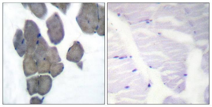 Acetyl-CoA Carboxylase / ACC Antibody - P-peptide - + Immunohistochemical analysis of paraffin-embedded human skeletal muscle tissue using ACC1 (Phospho-Ser80) antibody.