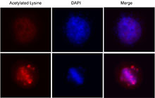 Acetyl-Lysine Antibody - Untreated Hela cells (Upper Panel), or overnight nocodazole treated Hela cells (Lower Panel) stained with purified mouse monoclonal antibody against Acetylated Lysine (clone 15G10), followed by Rhodamine Red-X conjugated Donkey anti-mouse IgG and DAPI.