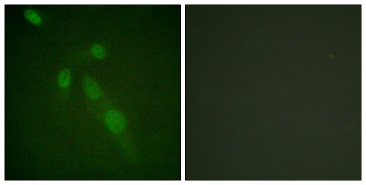 Acetyl-Lysine Antibody - Immunofluorescence analysis of HeLa cells, using Lys-Acetylated Proteins Antibody. The picture on the right is blocked with the synthesized peptide.