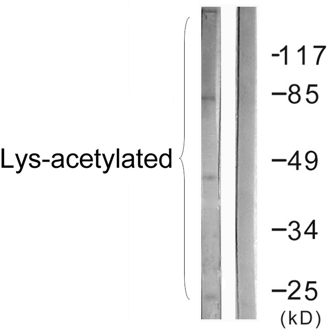 Acetyl-Lysine Antibody - Western blot analysis of lysates from COS7 cells treated with TSA 400uM 24h, using Lys-Acetylated Proteins Antibody. The lane on the right is blocked with the synthesized peptide.