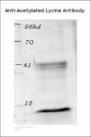 Acetyl-Lysine Antibody - Western blot analysis of the acetylated histone from TSA-treated mouse spleen cells.