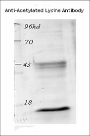 Acetyl-Lysine Antibody - Western blot analysis of the acetylated histone from TSA-treated mouse spleen cells.