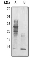 Acetyl-Lysine Antibody - Western blot analysis of Acetyl Lysine expression in mouse brain (A); HeLa TSA-treated (B) whole cell lysates.