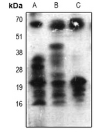 Acetyl-Lysine Antibody - Western blot analysis of Acetyl Lysine expression in HeLa (A); NIH3T3 (B); rat brain (C) whole cell lysates.
