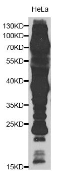 Acetyl-Lysine Antibody - Western blot analysis of extracts of HeLa cells, using Pan Acetyl-Lysine antibody. The secondary antibody used was an HRP Goat Anti-Rabbit IgG (H+L) at 1:10000 dilution. Lysates were loaded 25ug per lane and 3% nonfat dry milk in TBST was used for blocking.
