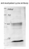 Acetyl-Lysine Antibody - Western blot analysis of acetylated histone from TSA-treated mouse spleen cells.