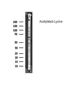 Acetyl-Lysine Antibody - Western blot analysis of Acetylated-Lysine using Acetyl Lysine antibody.