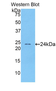 ACHE / Acetylcholinesterase Antibody - Western blot of recombinant ACHE / Acetylcholinesterase.  This image was taken for the unconjugated form of this product. Other forms have not been tested.