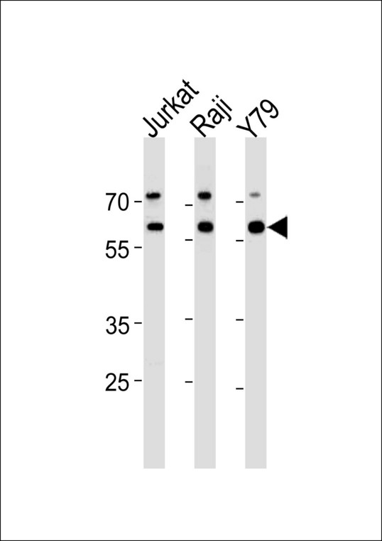 ACHE / Acetylcholinesterase Antibody - ACHE Antibody western blot of Jurkat,Raji,Y79 cell line lysates (35 ug/lane). The ACHE antibody detected the ACHE protein (arrow).