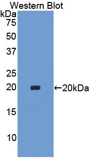 ACHE / Acetylcholinesterase Antibody - Western Blot; Sample: Recombinant protein.