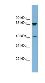 ACHE / Acetylcholinesterase Antibody - ACHE / Acetylcholinesterase antibody Western blot of THP-1 cell lysate. This image was taken for the unconjugated form of this product. Other forms have not been tested.