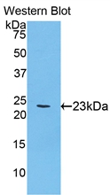 ACHE / Acetylcholinesterase Antibody - Western Blot; Sample: Recombinant protein.