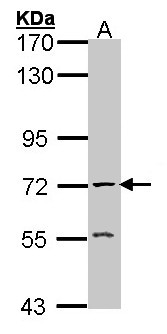 ACHE / Acetylcholinesterase Antibody - Sample (30 ug of whole cell lysate). A: Raji. 7.5% SDS PAGE. ACHE / Acetylcholinesterase antibody diluted at 1:1000.
