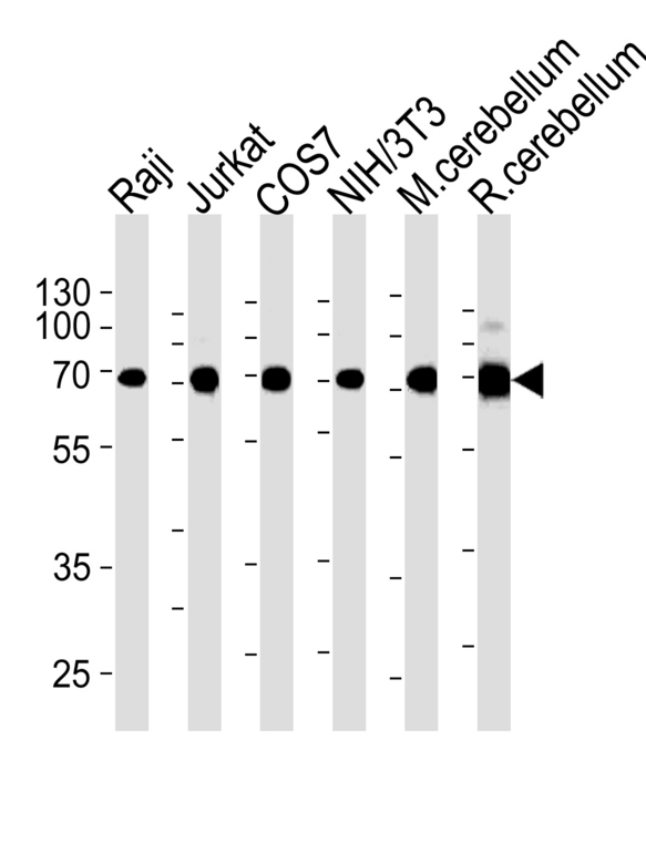 ACHE / Acetylcholinesterase Antibody - ACHE Antibody western blot of Raji, Jurkat, COS7, mouse NIH/3T3 cell line and mouse cerebellum, rat cerebellum tissue lysates (35 ug/lane). The ACHE antibody detected the ACHE protein (arrow).