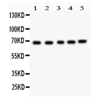 ACHE / Acetylcholinesterase Antibody - ACHE antibody Western blot. All lanes: Anti ACHE at 0.5 ug/ml. Lane 1: Rat Kidney Tissue Lysate at 50 ug. Lane 2: Mouse Liver Tissue Lysate at 50 ug. Lane 3: HELA Whole Cell Lysate at 40 ug. Lane 4: PANC Whole Cell Lysate at 40 ug. Lane 5: COLO320 Whole Cell Lysate at 40 ug. Predicted band size: 68 kD. Observed band size: 68 kD.
