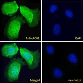 ACHE / Acetylcholinesterase Antibody - ACHE / Acetylcholinesterase antibody immunofluorescence analysis of paraformaldehyde fixed U2OS cells, permeabilized with 0.15% Triton. Primary incubation 1hr (10ug/ml) followed by Alexa Fluor 488 secondary antibody (2ug/ml), showing vesicle staining. The nuclear stain is DAPI (blue).