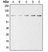 ACHE / Acetylcholinesterase Antibody - Western blot analysis of Acetylcholinesterase expression in HeLa (A); HEK293T (B); mouse liver (C); rat kidney (D); PC12 (E) whole cell lysates.