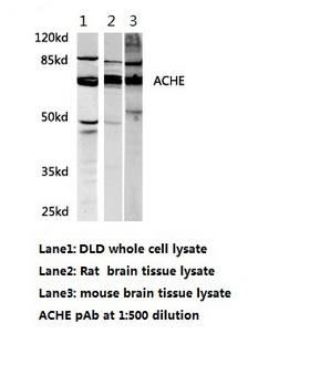 ACHE / Acetylcholinesterase Antibody - Western blot.