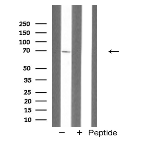 ACHE / Acetylcholinesterase Antibody - Western blot analysis of ACHE expression in HepG2 cells