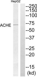 ACHE / Acetylcholinesterase Antibody - Western blot analysis of extracts from HepG2 cells, using ACHE antibody.