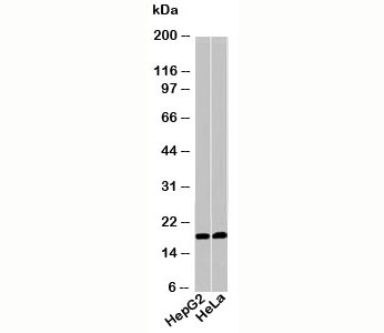 Acid Phosphatase Antibody - Acid Phosphatase / AP1 antibody western blot of human samples