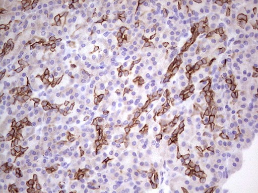 Acidic Cytokeratin AE1 Antibody - IHC of paraffin-embedded Human pancreas tissue using anti-Acidic Cytokeratin mouse monoclonal antibody.