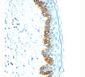 Acidic Cytokeratin AE1 Antibody - Acidic Cytokeratin antibody AE1 immunohistochemistry skin.  This image was taken for the unmodified form of this product. Other forms have not been tested.