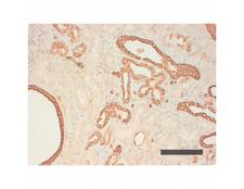 Acidic Cytokeratin AE1 Antibody - Human kidney (paraffin embedded) stained with Cytokeratin type I (AE1)