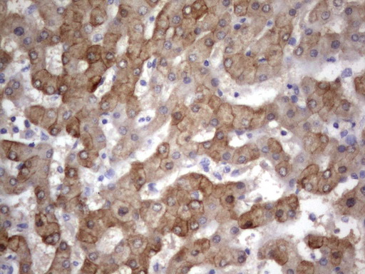 Acidic Cytokeratin Antibody - IHC of paraffin-embedded Human liver tissue using anti-Acidic CK rat monoclonal antibody.