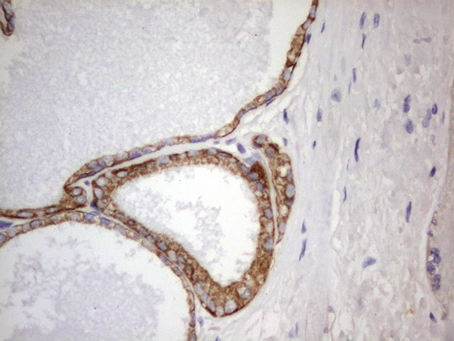 Acidic Cytokeratin Antibody - IHC of paraffin-embedded Human prostate tissue using anti-Acidic CK rat monoclonal antibody.
