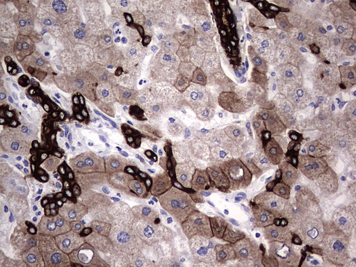 Acidic Cytokeratin Antibody - IHC of paraffin-embedded Human liver tissue using anti-Acidic CK rat monoclonal antibody.