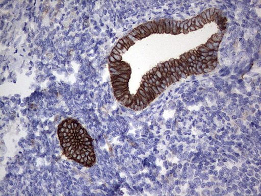 Acidic Cytokeratin Antibody - IHC of paraffin-embedded Human endometrium tissue using anti-Acidic CK rat monoclonal antibody.