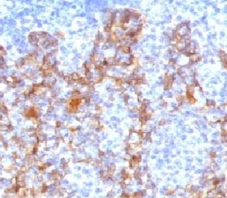 Acidic Cytokeratin Antibody - IHC testing of FFPE human tonsil with Acidic Cytokeratin antibody (clone ACCK1-1).  This image was taken for the unmodified form of this product. Other forms have not been tested.
