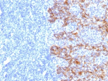Acidic Cytokeratin Antibody - IHC staining of FFPE human tonsil tissue with Acidic Cytokeratin antibody (clone SPM115). HIER: boil tissue sections in pH6, 10mM citrate buffer, for 10-20 min and allow to cool before testing.