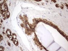 Acidic Cytokeratin Antibody - IHC of paraffin-embedded Human breast tissue using anti-Acidic CK rat monoclonal antibody.
