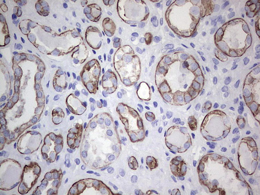 Acidic Cytokeratin Antibody - IHC of paraffin-embedded Human Kidney tissue using anti-Acidic CK rat monoclonal antibody.