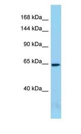 ACIN1 / Acinus Antibody - ACIN1 / Acinus antibody Western Blot of Mouse Small Intestine. Antibody dilution: 1 ug/ml.  This image was taken for the unconjugated form of this product. Other forms have not been tested.