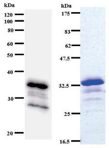 ACIN1 / Acinus Antibody - Western blot of immunized recombinant protein using ACIN1 antibody. Left: ACIN1 staining. Right: Coomassie Blue staining of immunized recombinant protein.