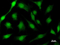 ACIN1 / Acinus Antibody - Immunostaining analysis in HeLa cells. HeLa cells were fixed with 4% paraformaldehyde and permeabilized with 0.1% Triton X-100 in PBS. The cells were immunostained with anti-ACIN1 mAb.