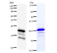 ACIN1 / Acinus Antibody - Left : Western blot analysis of immunized recombinant protein, using anti-ACIN1 monoclonal antibody. Right : CBB staining of immunized recombinant protein.