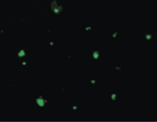 ACIN1 / Acinus Antibody - Immunofluorescence of Acinus in HeLa cells with Acinus antibody at 10 ug/ml.