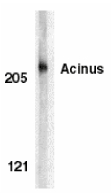 ACIN1 / Acinus Antibody - Western blot of Acinus in K562 whole cell lysate with Acinus antibody at 1 ug/ml.