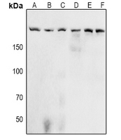 ACIN1 / Acinus Antibody - Western blot analysis of Acinus (pS1180) expression in A549 (A), Hela (B), Jurkat (C), NIH3T3 (D), H9C2 (E), PC12 (F) whole cell lysates.
