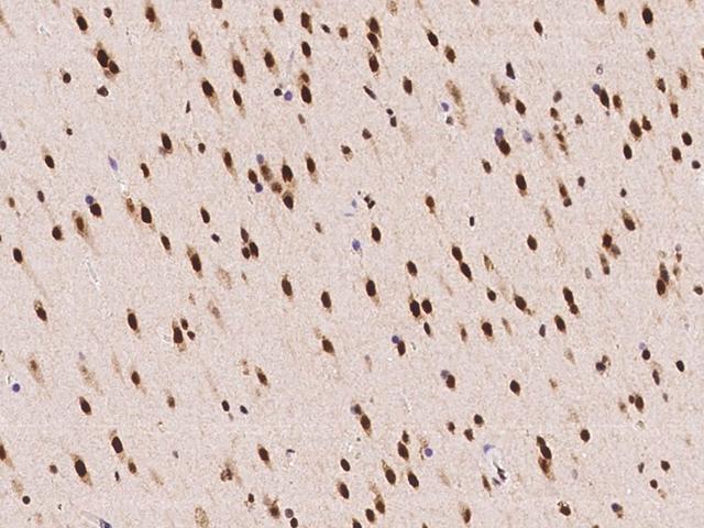 ACIN1 / Acinus Antibody - Immunochemical staining of human ACIN1 in human brain with rabbit polyclonal antibody at 1:100 dilution, formalin-fixed paraffin embedded sections.