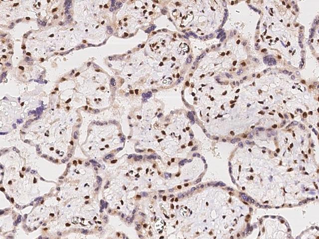 ACIN1 / Acinus Antibody - Immunochemical staining of human ACIN1 in human placenta with rabbit polyclonal antibody at 1:100 dilution, formalin-fixed paraffin embedded sections.