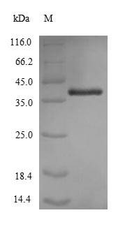 omp38 Protein - (Tris-Glycine gel) Discontinuous SDS-PAGE (reduced) with 5% enrichment gel and 15% separation gel.