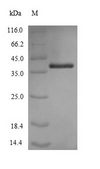 omp38 Protein - (Tris-Glycine gel) Discontinuous SDS-PAGE (reduced) with 5% enrichment gel and 15% separation gel.