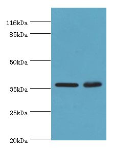 ACKR1 / DARC Antibody - Western blot. All lanes: ACKR1 antibody at 2 ug/ml Lane 1:mouse kidney tissue. Lane 2mouse spleen tissue. Secondary antibody: Goat polyclonal to rabbit at 1:10000 dilution. Predicted band size: 36 kDa. Observed band size: 36 kDa.  This image was taken for the unconjugated form of this product. Other forms have not been tested.